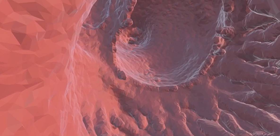 A 3D view of a coronary vessel in VRAI-Heart's software